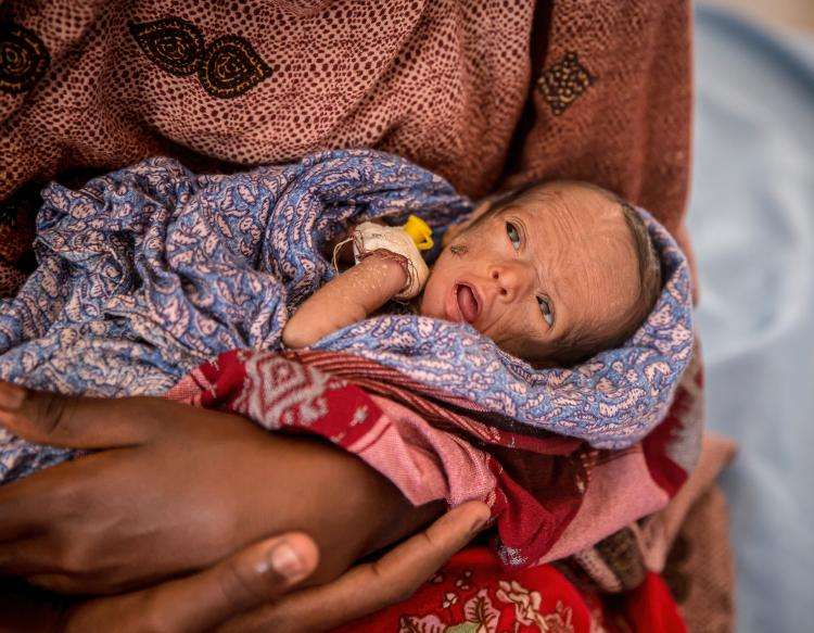 Lille underernæret barn på Afrikas Horn